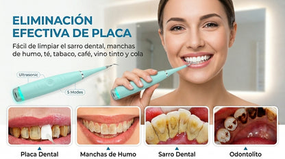 Removedor de sarro Dental Recargable